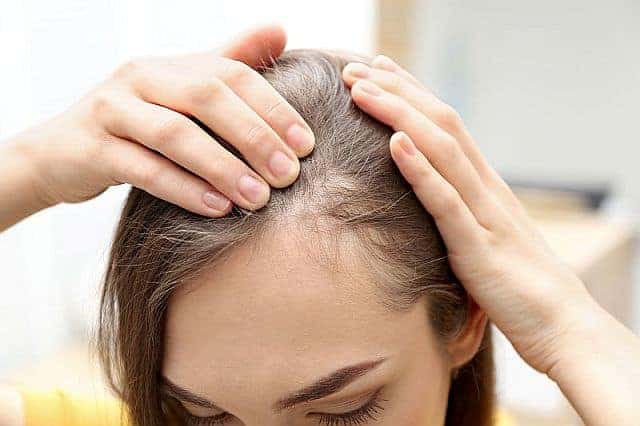 woman with thinning hair at the forehead